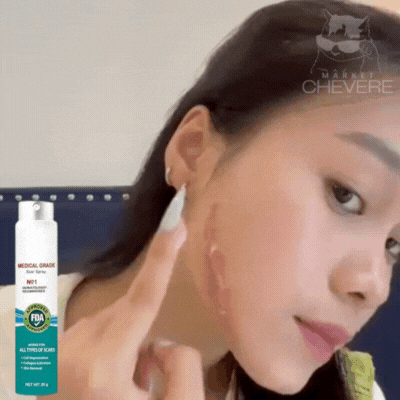 SCAR SKIN SPRAY™ Spray Anticicatrices Milagroso