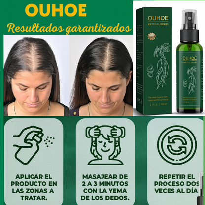 OUHOE™ Solución Caída de cabello