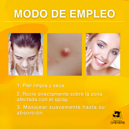 SKIN CLEAN SPRAY™ Spray Mágico para Verrugas