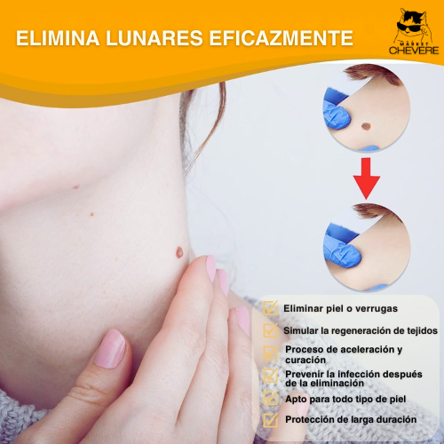 SKIN CLEAN SPRAY™ Spray Mágico para Verrugas