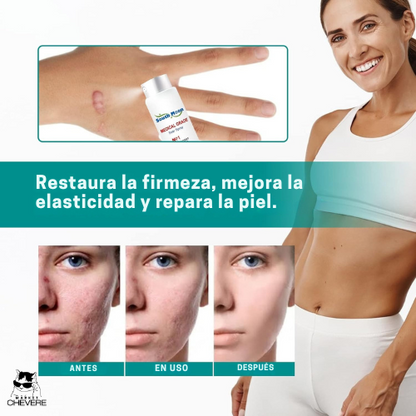 SCAR SKIN SPRAY™ Spray Anticicatrices Milagroso