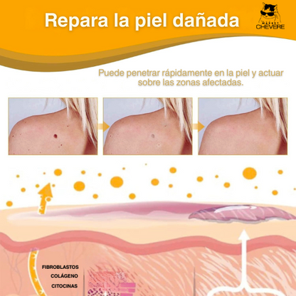 SKIN CLEAN SPRAY™ Spray Mágico para Verrugas