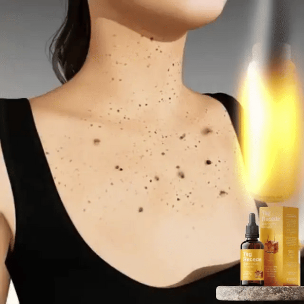 SKIN CLEAN SPRAY™ Spray Mágico para Verrugas